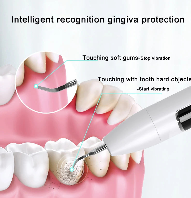 Xiaomi Visual Ultrasonic Dental Calculus Remover Teeth Plaque Scaler Stain Clean Electric Tooth Stone Removal Tartar Eliminator